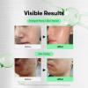 VT COSMETICS CICA Reedle Shot 300 Essence 1.69Fl Oz (50ml) & Korean Gingseng Vegan PDRN 100 Serum for Natural Glow 1.01 fl. Oz.